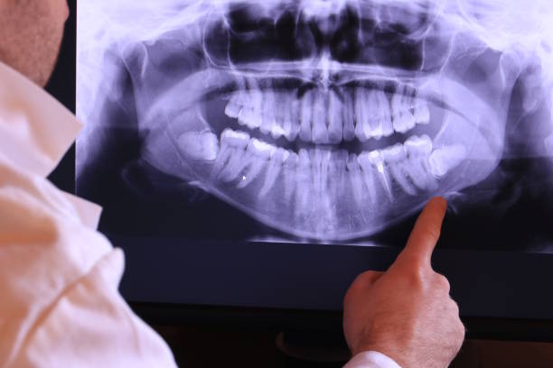 Best Emergency Dental Services for Seniors in Colorado City, AZ